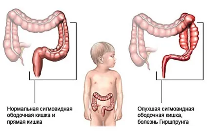 Затримка стільця у немовля як налагодити регулярність (стільця) Затримка стільця у немовля як налагодити регулярність