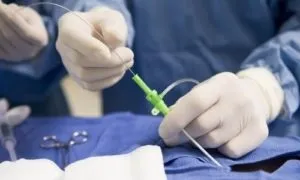 Заміна аортального клапана - вартість і реабілітація після операції на серці (вартість) Заміна аортального клапана - вартість і реабілітація після операції на серці