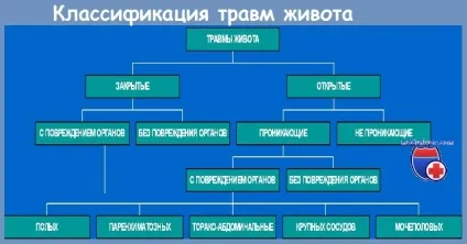 Закриті ушкодження живота (класифікація) Закриті ушкодження живота