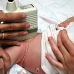 Чому випадає волосся у грудничка на голові (чому) Чому випадає волосся у грудничка на голові