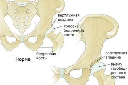 Чому хрустять суглоби у грудничка