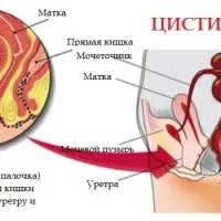 здоров'я мами