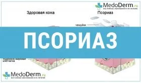 Заразний чи ні псоріаз передається псоріаз киснем (передається) Заразний чи ні псоріаз передається псоріаз дотиком