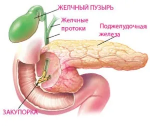 Застій жовчі симптоми і лікування, причини у дитини і дорослого (жовчі) Застій жовчі симптоми і лікування, причини у дитини і дорослого