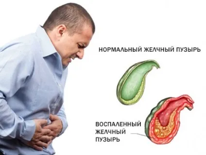 Запор - симптоми, профілактика і лікування запору народними засобами, книга здоров'я