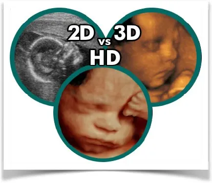 3D узі вагітності (УЗД плоду) (плода) 3D узі вагітності (УЗД плоду)