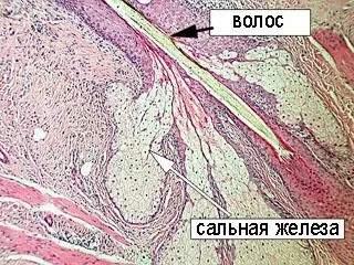 Анатомія сальних залоз