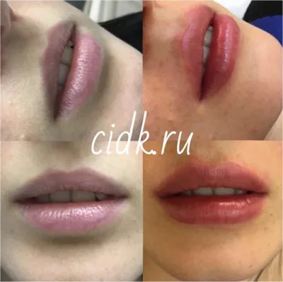 Центральний інститут дерматокосметології