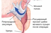 Чим підняти потенцію у чоловіка як викликати ерекцію (Початкове положення лежачи) Чим підняти потенцію у чоловіка як викликати ерекцію