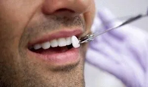 Що являють собою люмініри (собою) Що являють собою люмініри