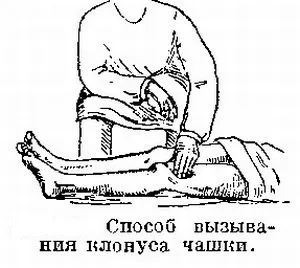 Що таке клонуси стоп і колінних чашечок причини, діагностика та лікування (клонус стопи) Що таке клонуси стоп і колінних чашечок причини, діагностика та лікування