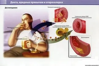 Дієта і засоби від атеросклерозу судин головного мозку (кошти) Дієта і засоби від атеросклерозу судин головного мозку