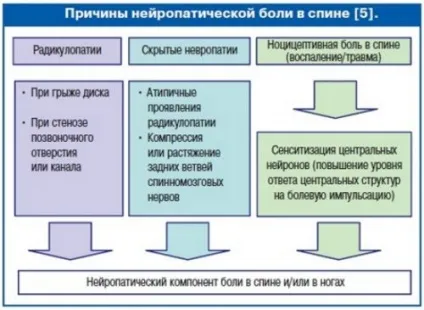 Дискогенна радикулопатия діагностика і лікування (радикулопатія) Дискогенна радикулопатия діагностика і лікування