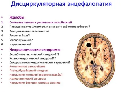 Дисциркуляторна енцефалопатія що це таке, як лікувати (дисциркуляторної енцефалопатії є) Дисциркуляторна енцефалопатія що це таке, як лікувати