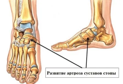 Показання до проведення МРТ стопи і гомілковостопного суглоба