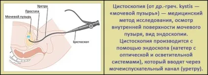 Фітолізин при циститі склад, як діє, як приймати, протипоказання, ціна, відгуки (циститі) Фітолізин при циститі склад, як діє, як приймати, протипоказання, ціна, відгуки