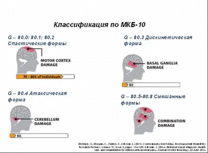 Форми і види ДЦП (атонически астатическая, спастична, гіперкінетична і інші) (гіперкінетична) Форми і види ДЦП (атонически астатическая, спастична, гіперкінетична і інші)