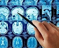 Гіпофункція передньої долі гіпофіза що це таке, до чого призводить