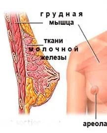 Гінекомастія помилкова у чоловіків (помилкова) Гінекомастія помилкова у чоловіків