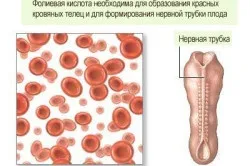 Гіперхромні анемія симптоми і лікування (гиперхромная) Гіперхромні анемія симптоми і лікування