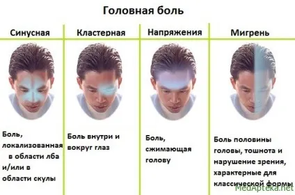 Головні болі тензіонного типу лікування, відгуки (лікування) Головні болі тензіонного типу лікування, відгуки