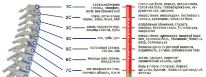 Грижа в шийному відділі хребта діагностика патології міжхребцевого диска (грижа) Грижа в шийному відділі хребта діагностика патології міжхребцевого диска