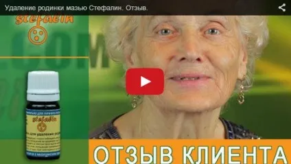 Говорун вадим валериевич, суми - ділимося досвідом видалення родимок (видалив) Говорун вадим валериевич, суми - ділимося досвідом видалення родимок