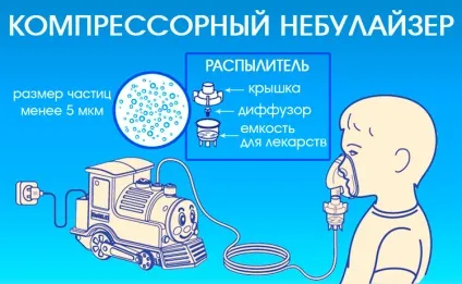 Інгаляції небулайзером при нежиті у дитини - рецепти для дітей