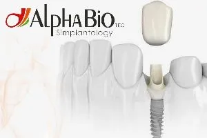 Ізраїльські імпланти alpha bio (альфа біо) переваги і недоліки, відгуки, ціни (alpha bio) Ізраїльські імпланти alpha bio (альфа біо) переваги і недоліки, відгуки, ціни