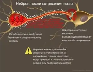 Наслідки струсу головного мозку як розпізнати і що робити (струсу) Наслідки струсу головного мозку як розпізнати і що робити