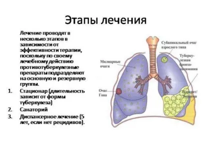 Як розпізнати туберкульоз симптоми і перші ознаки у дорослого на ранніх стадіях (розпізнати) Як розпізнати туберкульоз симптоми і перші ознаки у дорослого на ранніх стадіях