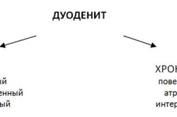 Катаральний дуоденіт що це таке, симптоми і лікування