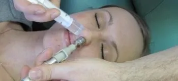 Катаральний гайморит види, симптоми і лікування, профілактика (гайморит) Катаральний гайморит види, симптоми і лікування, профілактика