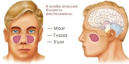 Катаральний гайморит види, симптоми і лікування, профілактика (катаральний) Катаральний гайморит види, симптоми і лікування, профілактика