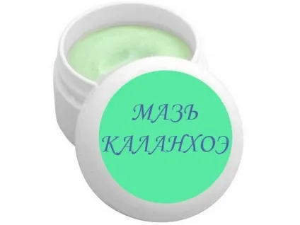 Каланхое при лікуванні гаймориту
