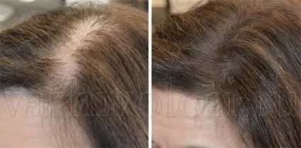 Консилер для волосся Лореаль Хейр тач ап (hair touch up), фарби, ваше волосся (touch) Консилер для волосся Лореаль Хейр тач ап (hair touch up), фарби, ваше волосся