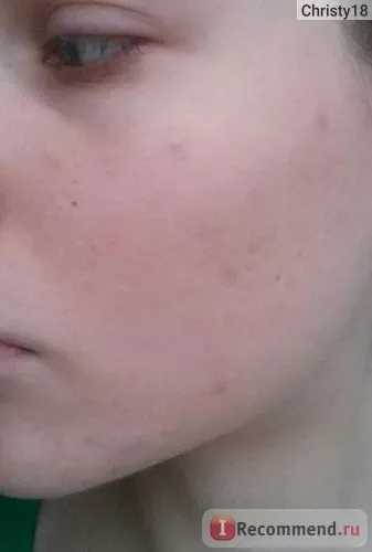 Крем для проблемної шкіри the skin house wrinkle snail system cream - «кращий крем для проблемної (шкіри) Крем для проблемної шкіри the skin house wrinkle snail system cream - «кращий крем для проблемної