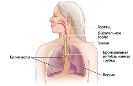 Круп у дитини - симптоми хвороби, профілактика і лікування крупа у дитини, причини захворювання і (захворювання) Круп у дитини - симптоми хвороби, профілактика і лікування крупа у дитини, причини захворювання і