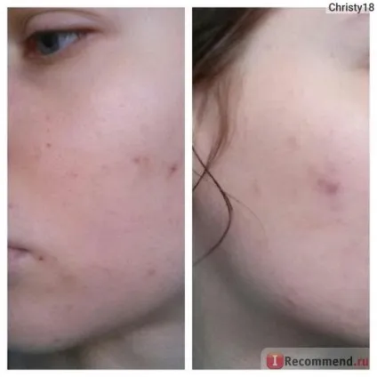 Крем для проблемної шкіри the skin house wrinkle snail system cream - «кращий крем для проблемної (skin) Крем для проблемної шкіри the skin house wrinkle snail system cream - «кращий крем для проблемної