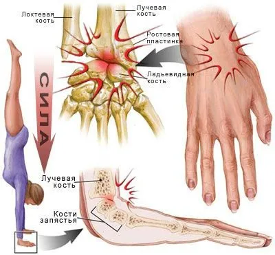 Променевозап'ястний суглоб будова (анатомія), функції і захворювання (суглоб) Променевозап'ястний суглоб будова (анатомія), функції і захворювання