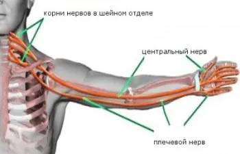 Причини і лікування оніміння пальців правої руки (руки) Причини і лікування оніміння пальців правої руки