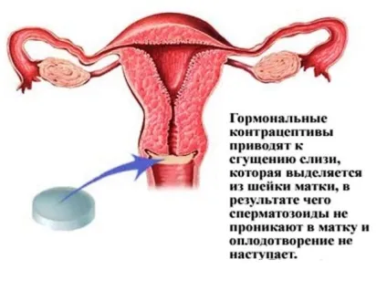 Місячні після скасування ок які бувають - мізерні, рясні, мазня, коричневі, хворобливі, (після) Місячні після скасування ок які бувають - мізерні, рясні, мазня, коричневі, хворобливі,