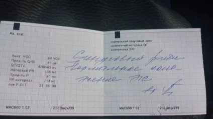 Порушення ритму серця симптоми захворювання, способи лікування (способи) Порушення ритму серця симптоми захворювання, способи лікування