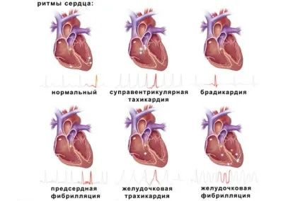 Порушення ритму серця симптоми захворювання, способи лікування (симптоми) Порушення ритму серця симптоми захворювання, способи лікування