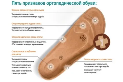 Взуття для діабетиків вибір ортопедичного взуття для діабетичної стопи (вибір) Взуття для діабетиків вибір ортопедичного взуття для діабетичної стопи