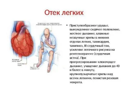 Вогнищева пневмонія у дітей симптоми і лікування, правосторонній і лівосторонній запалення лекгих, (дітей) Вогнищева пневмонія у дітей симптоми і лікування, правосторонній і лівосторонній запалення лекгих,