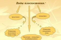 Операція при плоскостопості