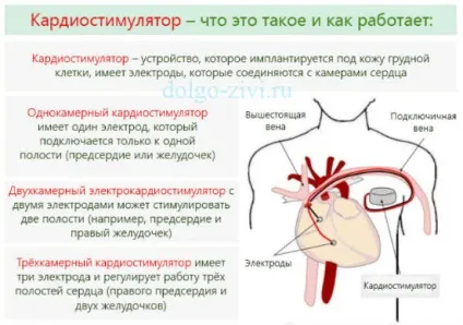 Чи небезпечна екстрасистолія позачергове скорочення загрожує насосної функції серця (скорочення) Чи небезпечна екстрасистолія позачергове скорочення загрожує насосної функції серця