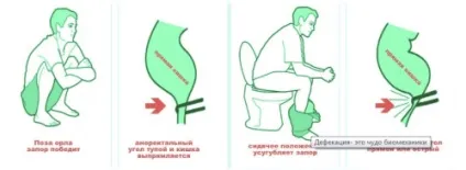 Перелік продуктів, фруктів і овочів які проносять кишечник