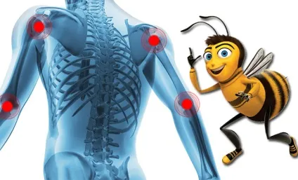 Підмор в лікуванні варикозу